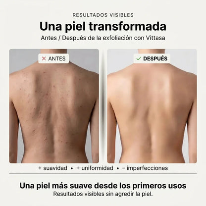 Velura™ - Toalla de ducha exfoliante